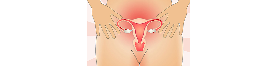 Saiba mais sobre Endometriose